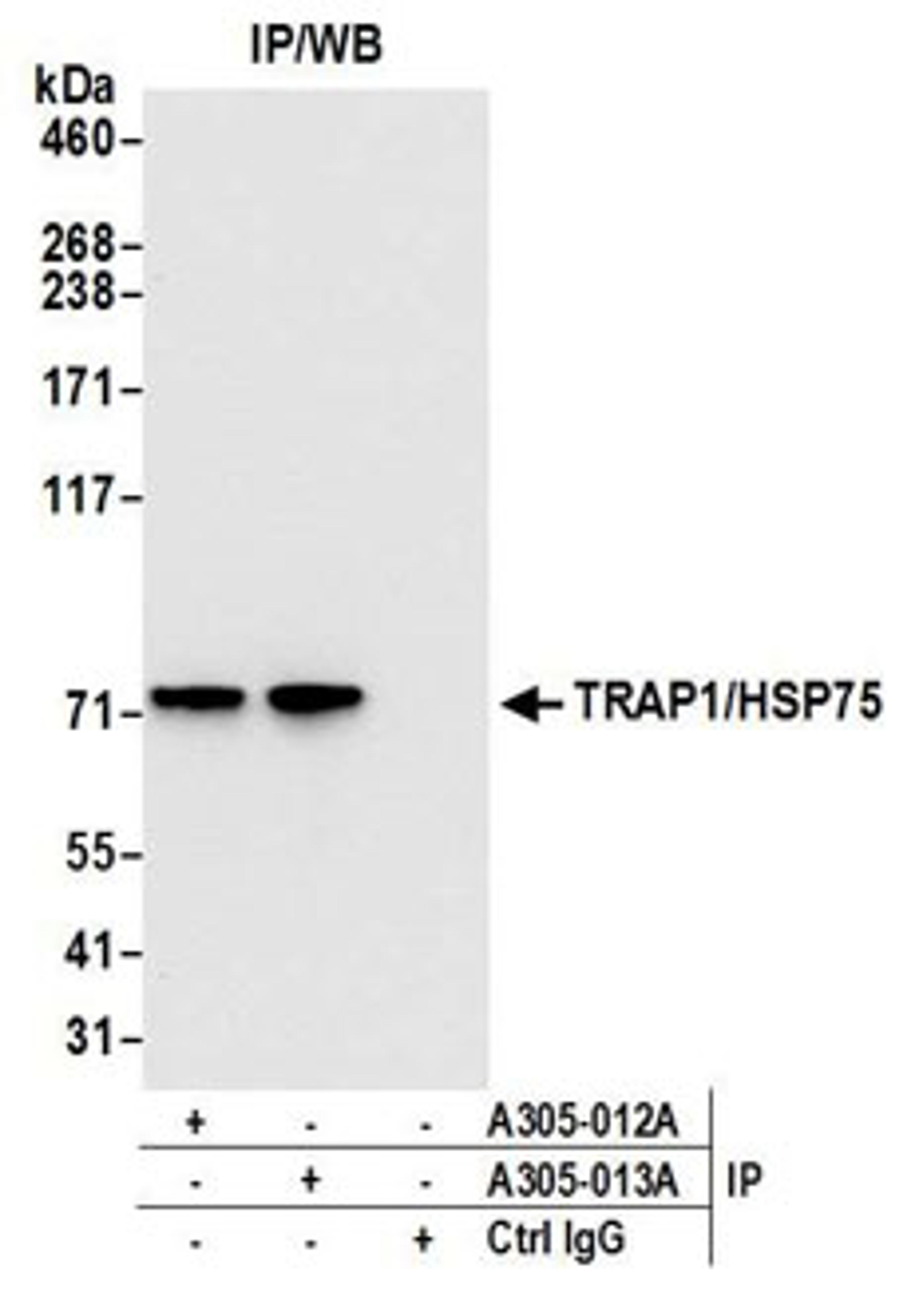 Detection of human TRAP1/HSP75 by western blot of immunoprecipitates.