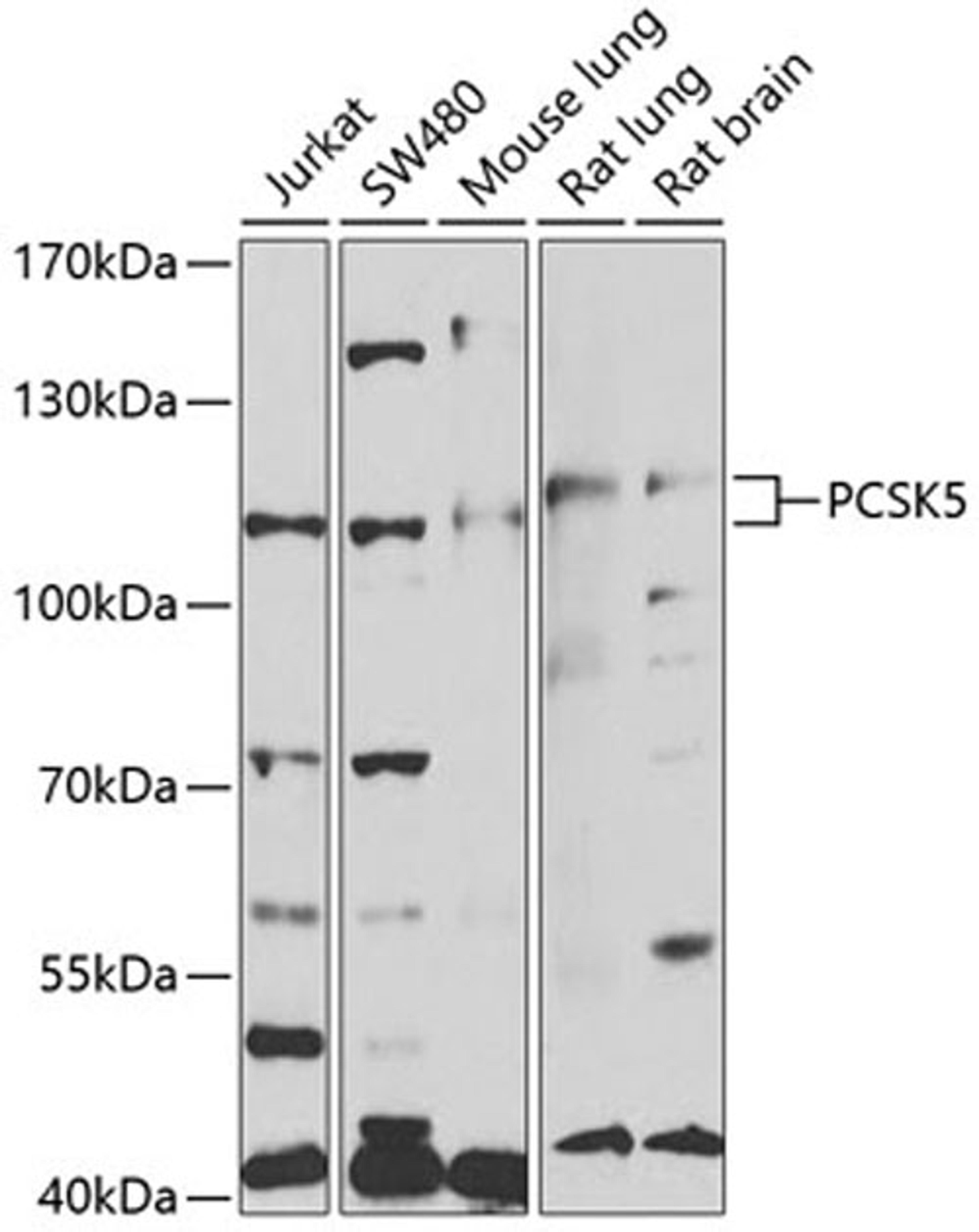 Western blot - PCSK5 antibody (A5450)