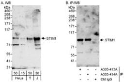 Detection of human STIM1 by western blot and immunoprecipitation.