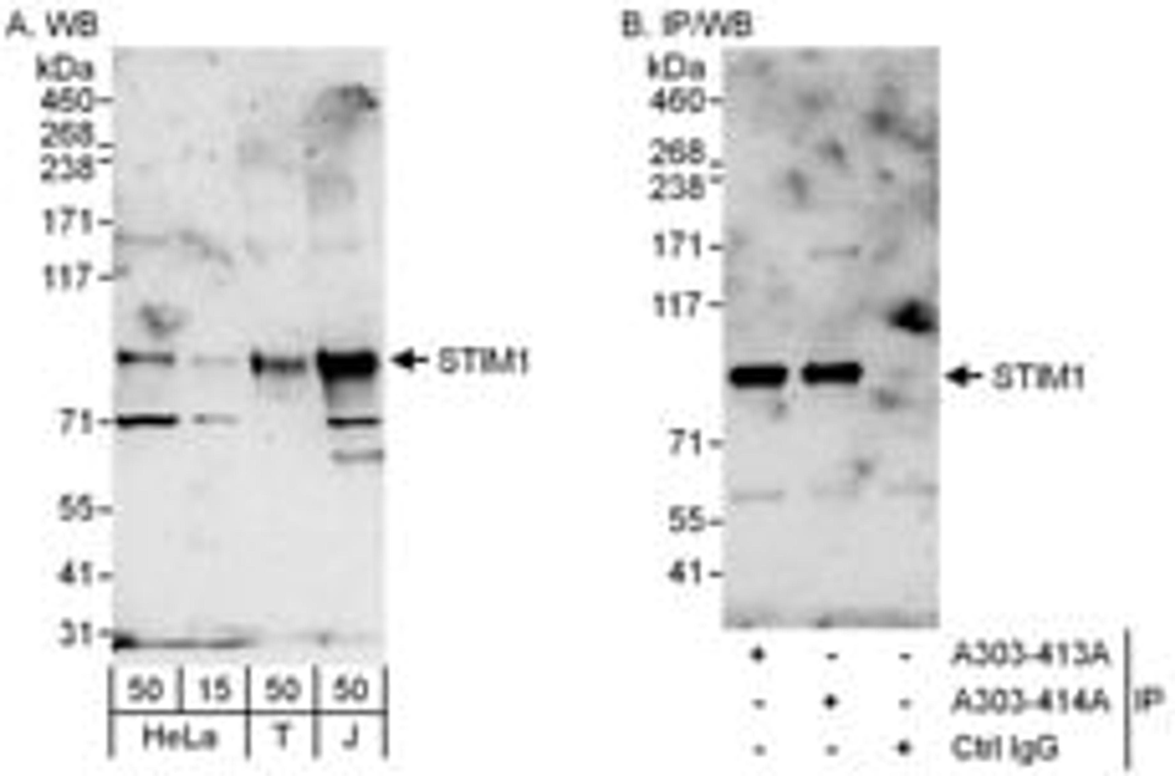 Detection of human STIM1 by western blot and immunoprecipitation.