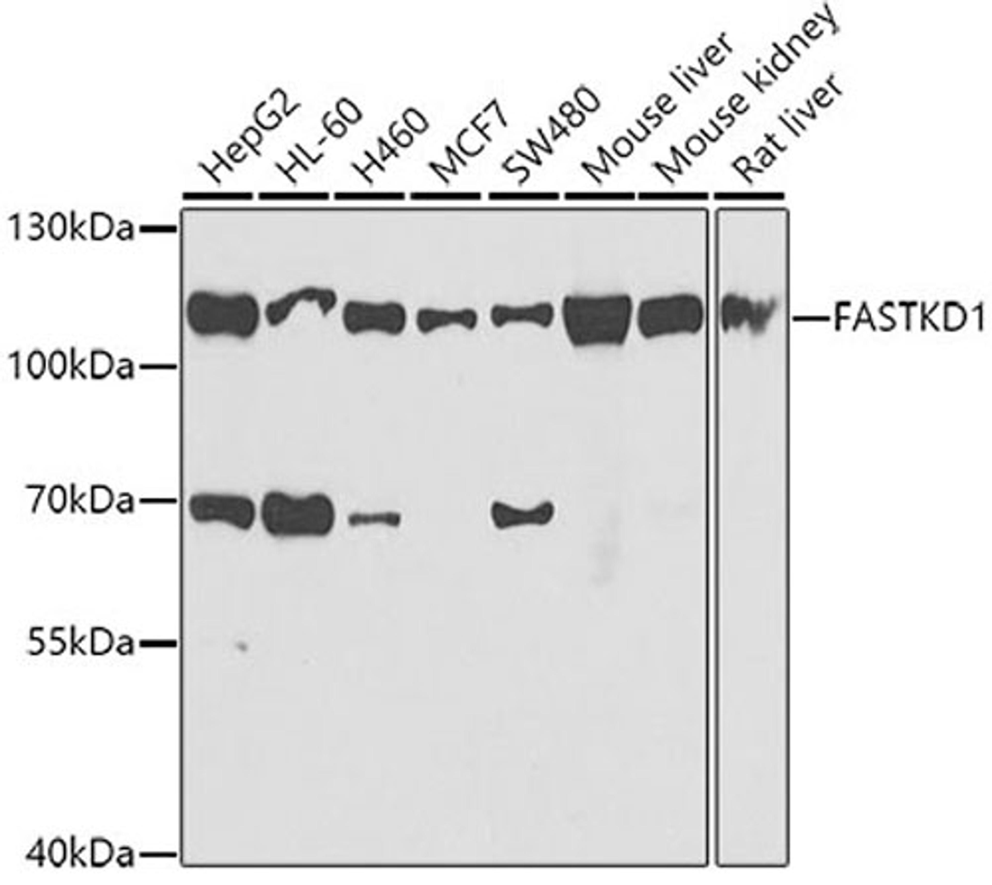 Western blot - FASTKD1 antibody (A7384)