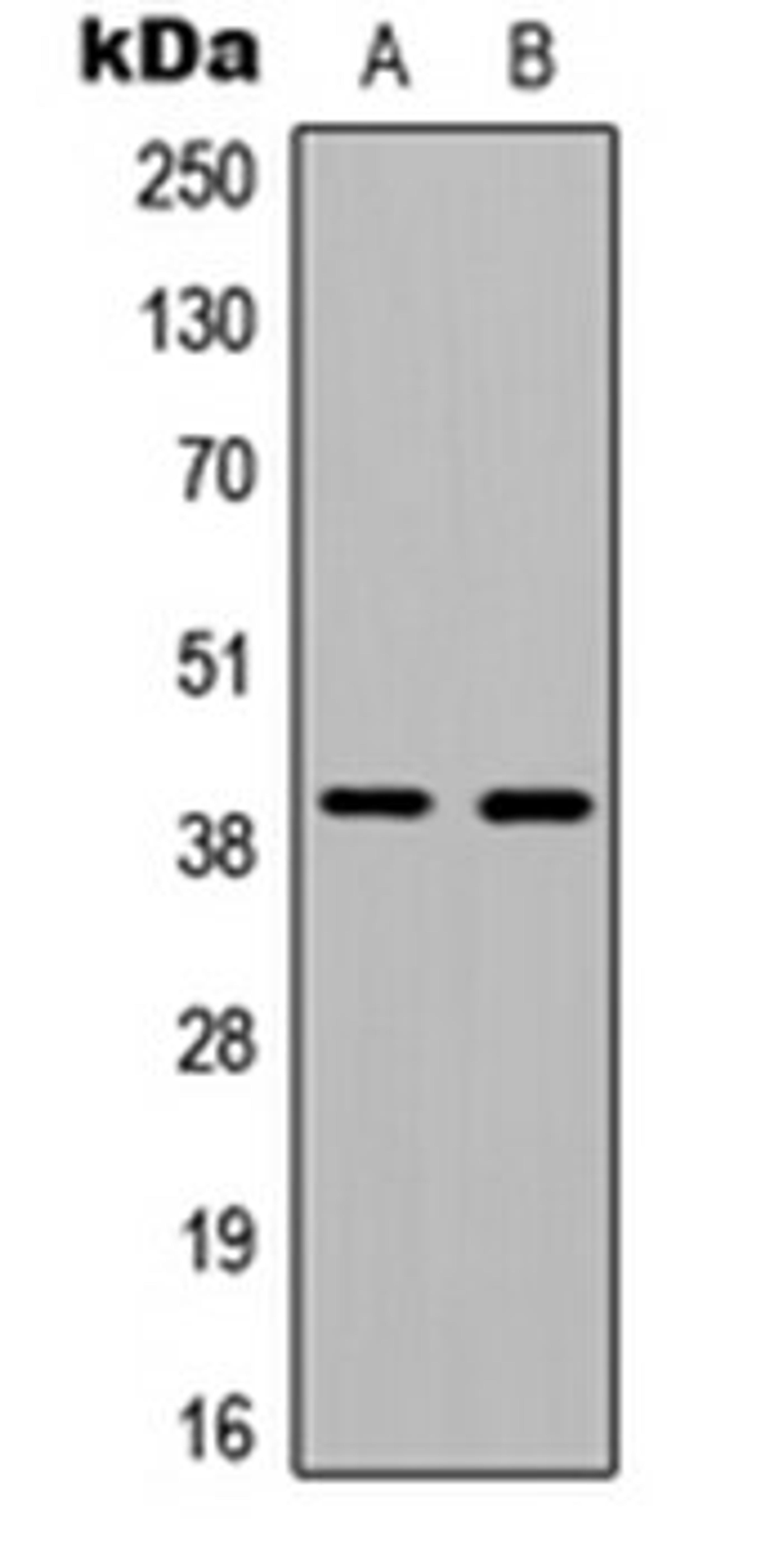 Western blot analysis of HEK293T (Lane 1), MCF7 (Lane 2) whole cell lysates using Ataxin 7L3 antibody