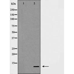 Western blot analysis of COLO cells using S100 A10 antibody