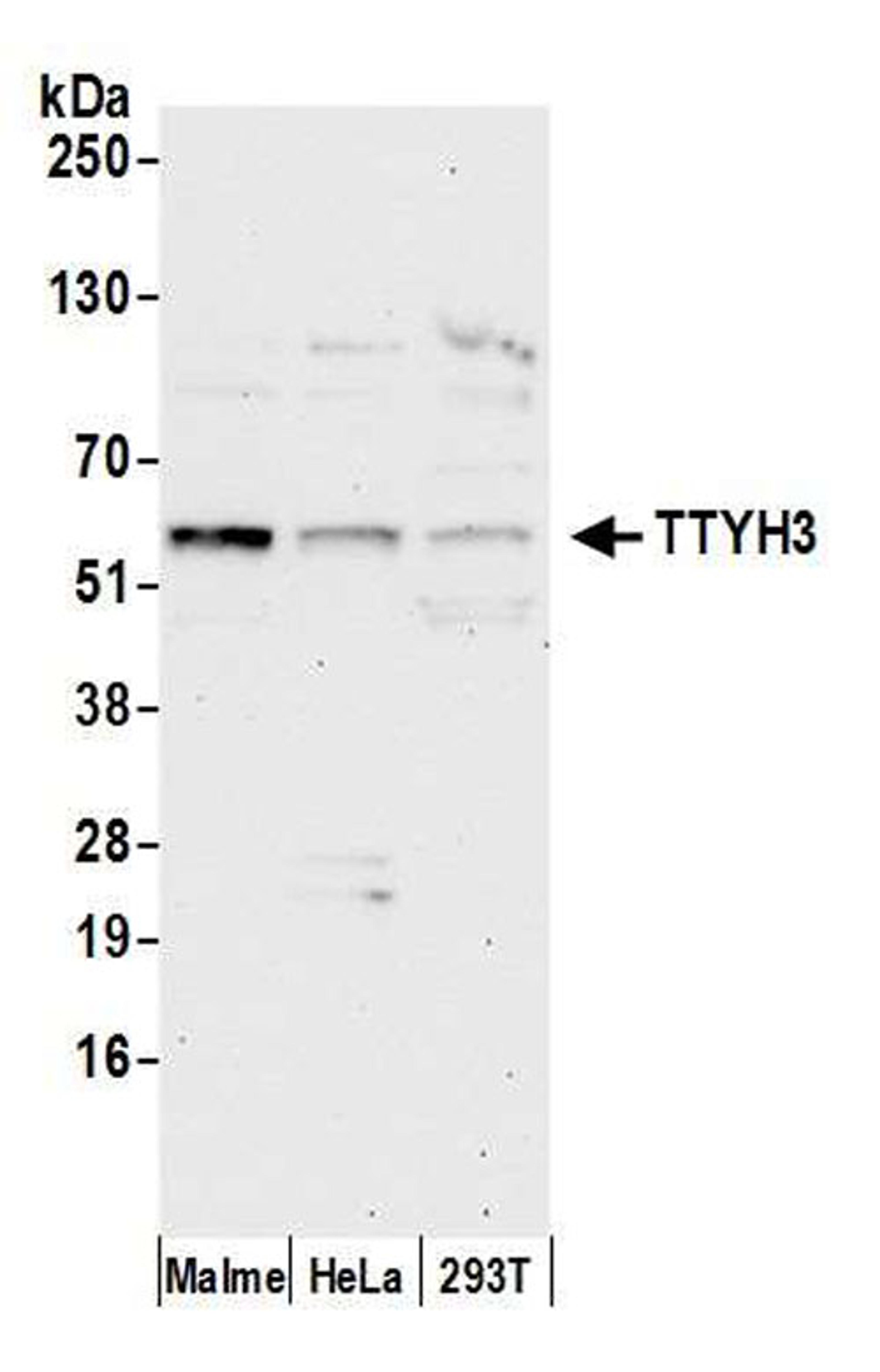 Detection of human TTYH3 by WB.