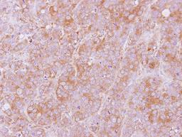 Immunohistochemistry-Paraffin: LMAN2 Antibody [NBP2-17153] - Immunohistochemical analysis of paraffin-embedded MCF7 xenograft, using antibody at 1:100 dilution.