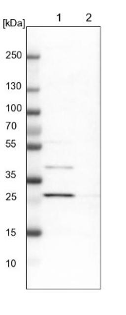 Western Blot: AK2 Antibody [NBP1-86043] - Lane 1: NIH-3T3 cell lysate (Mouse embryonic fibroblast cells)<br/>Lane 2: NBT-II cell lysate (Rat Wistar bladder tumour cells)