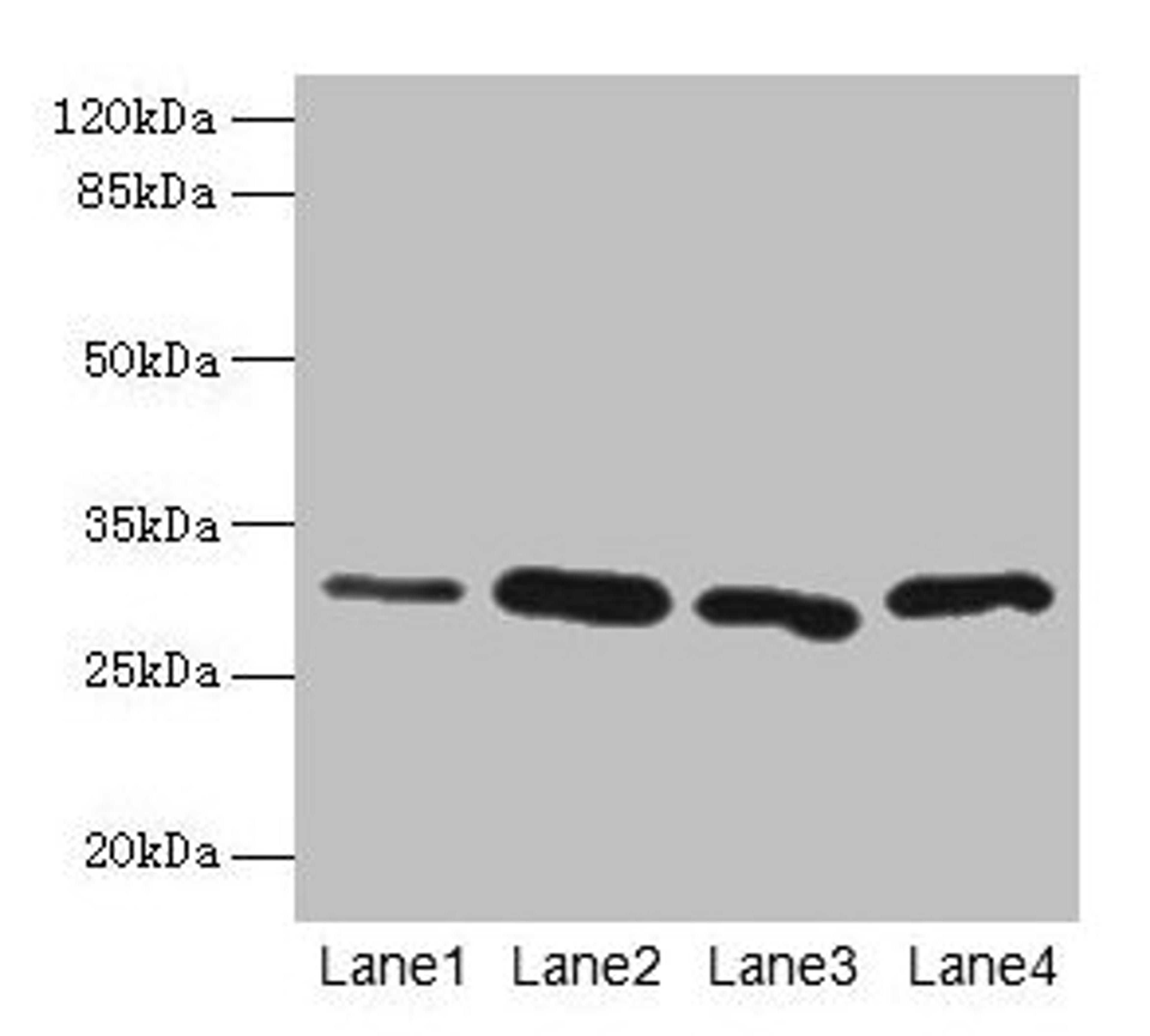 Western blot. All lanes: CA3 antibody at 2µg/ml. Lane 1: Hela whole cell lysate. Lane 2: HepG2 whole cell lysate. Lane 3: K562 whole cell lysate. Lane 4: NIH/3T3 whole cell lysate. Secondary. Goat polyclonal to rabbit IgG at 1/10000 dilution. Predicted band size: 30 kDa. Observed band size: 30 kDa