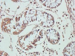 Immunohistochemical staining of pig large intestines tissue using anti-VEGF (2.5 ug/ml)