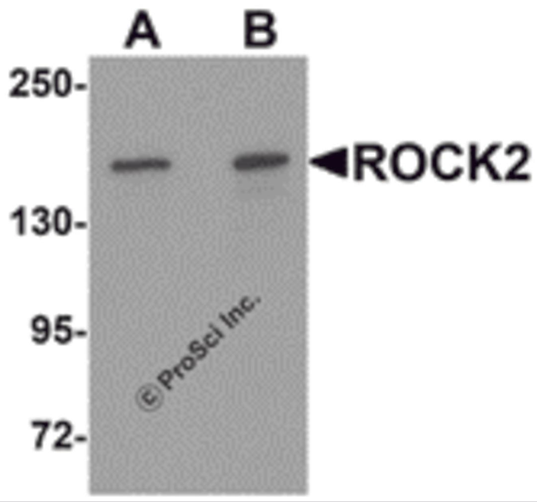 Western blot analysis of ROCK2 in mouse brain tissue lysate with ROCK2 antibody at (A) 1 and (B) 2 &#956;g/mL