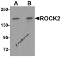 Western blot analysis of ROCK2 in mouse brain tissue lysate with ROCK2 antibody at (A) 1 and (B) 2 &#956;g/mL