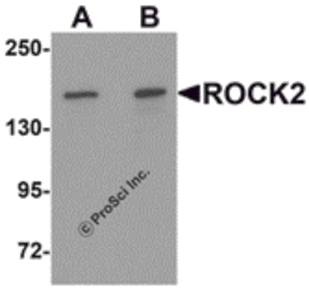 Western blot analysis of ROCK2 in mouse brain tissue lysate with ROCK2 antibody at (A) 1 and (B) 2 μg/mL