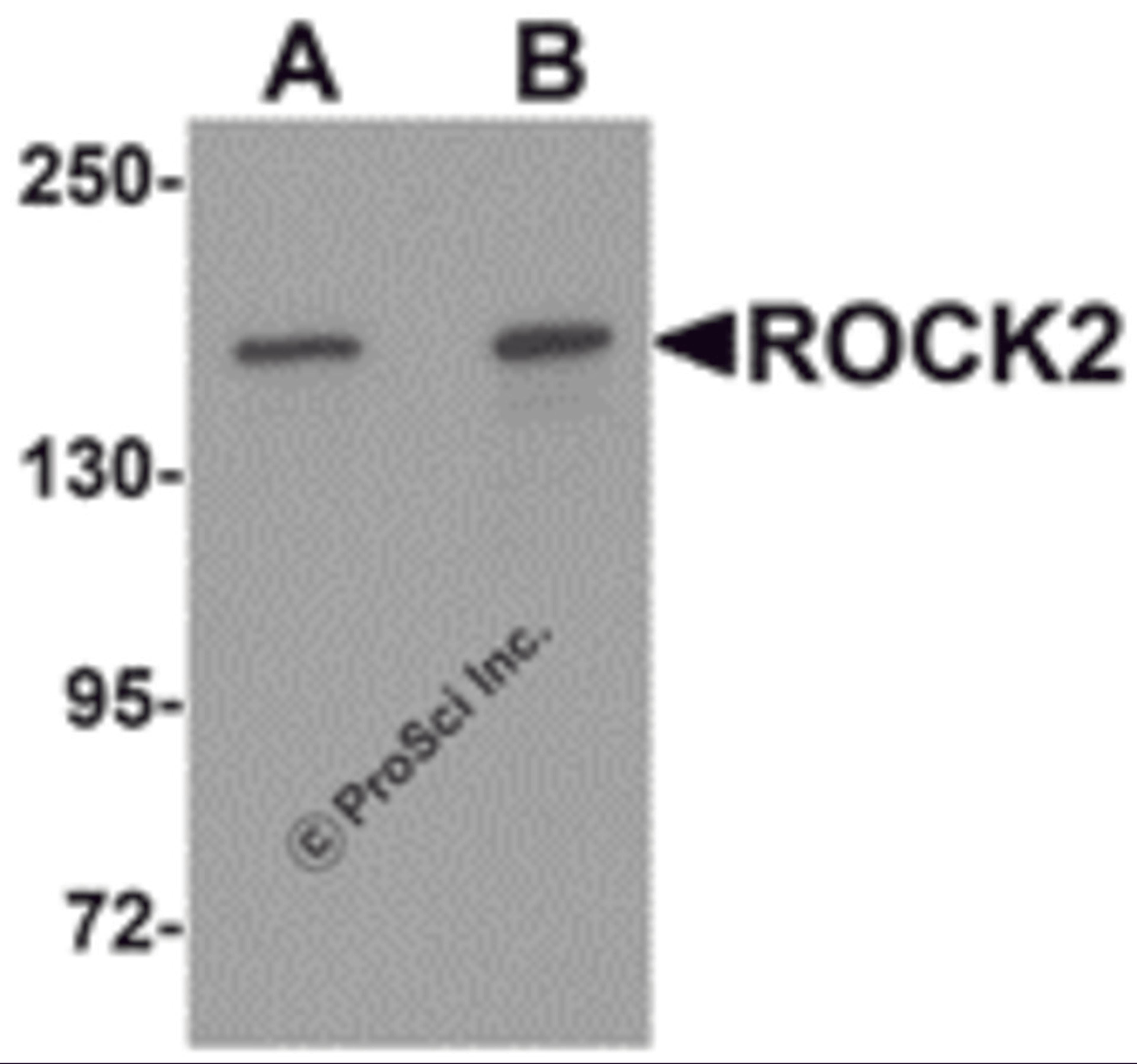 Western blot analysis of ROCK2 in mouse brain tissue lysate with ROCK2 antibody at (A) 1 and (B) 2 μg/mL