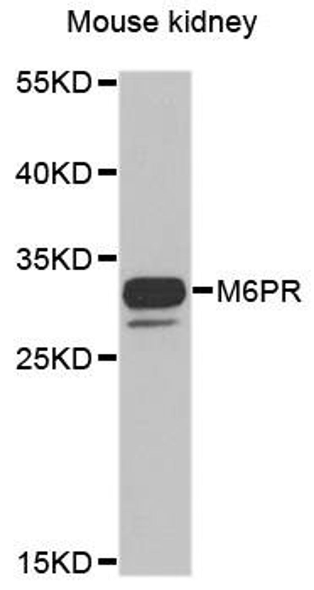 Western blot analysis of extracts of Mouse kidney cell line using M6PR antibody