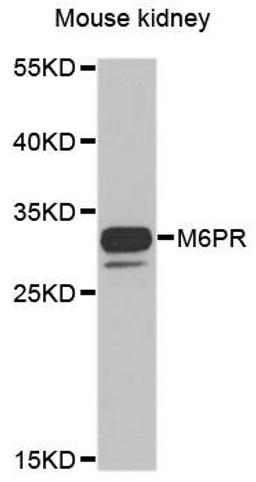 Western blot analysis of extracts of Mouse kidney cell line using M6PR antibody