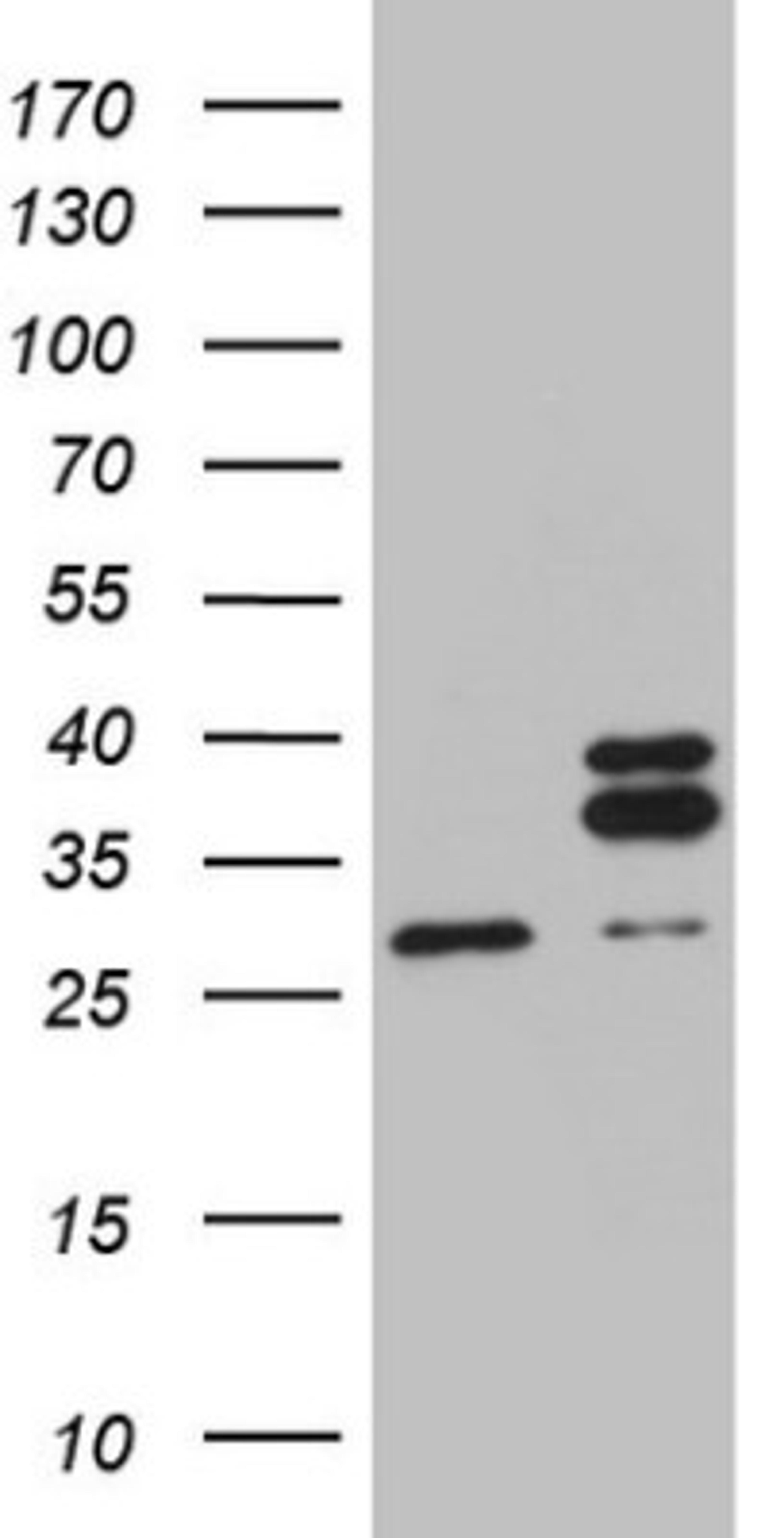 Western Blot: MRPL10 Antibody (2B4) [NBP2-45910] - Analysis of HEK293T cells were transfected with the pCMV6-ENTRY control (Left lane) or pCMV6-ENTRY MRPL10.