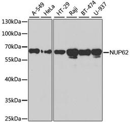 Western blot - NUP62 antibody (A2499)