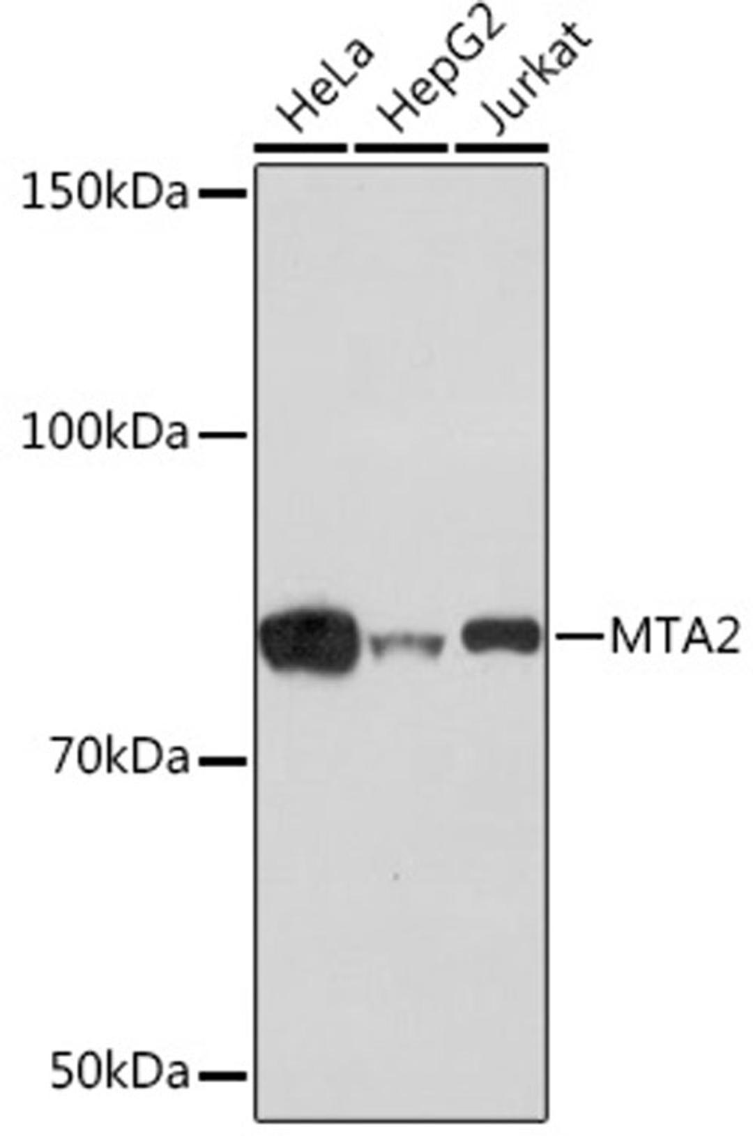 Western blot - MTA2 Rabbit mAb (A4624)