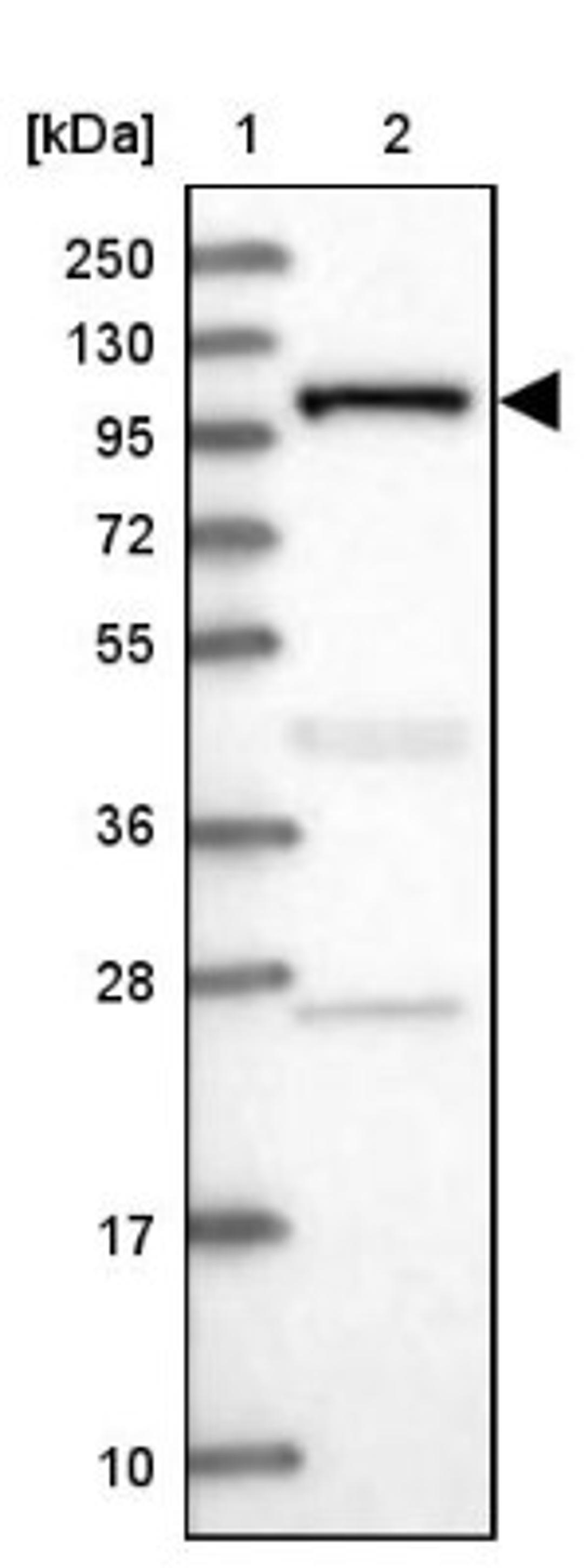 Western Blot: INPP4B Antibody [NBP1-85883] - Lane 1: Marker [kDa] 250, 130, 95, 72, 55, 36, 28, 17, 10<br/>Lane 2: Human cell line RT-4