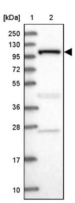 Western Blot: INPP4B Antibody [NBP1-85883] - Lane 1: Marker [kDa] 250, 130, 95, 72, 55, 36, 28, 17, 10<br/>Lane 2: Human cell line RT-4