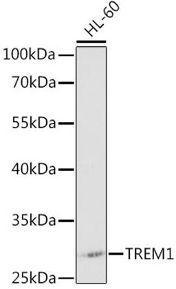 Western blot - TREM1 antibody (A0292)