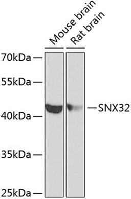 Western blot - SNX32 antibody (A8006)