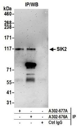 Detection of human SIK2 by western blot of immunoprecipitates.