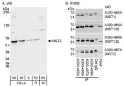 Detection of MST1 and MST2 by western blot and immunoprecipitation.