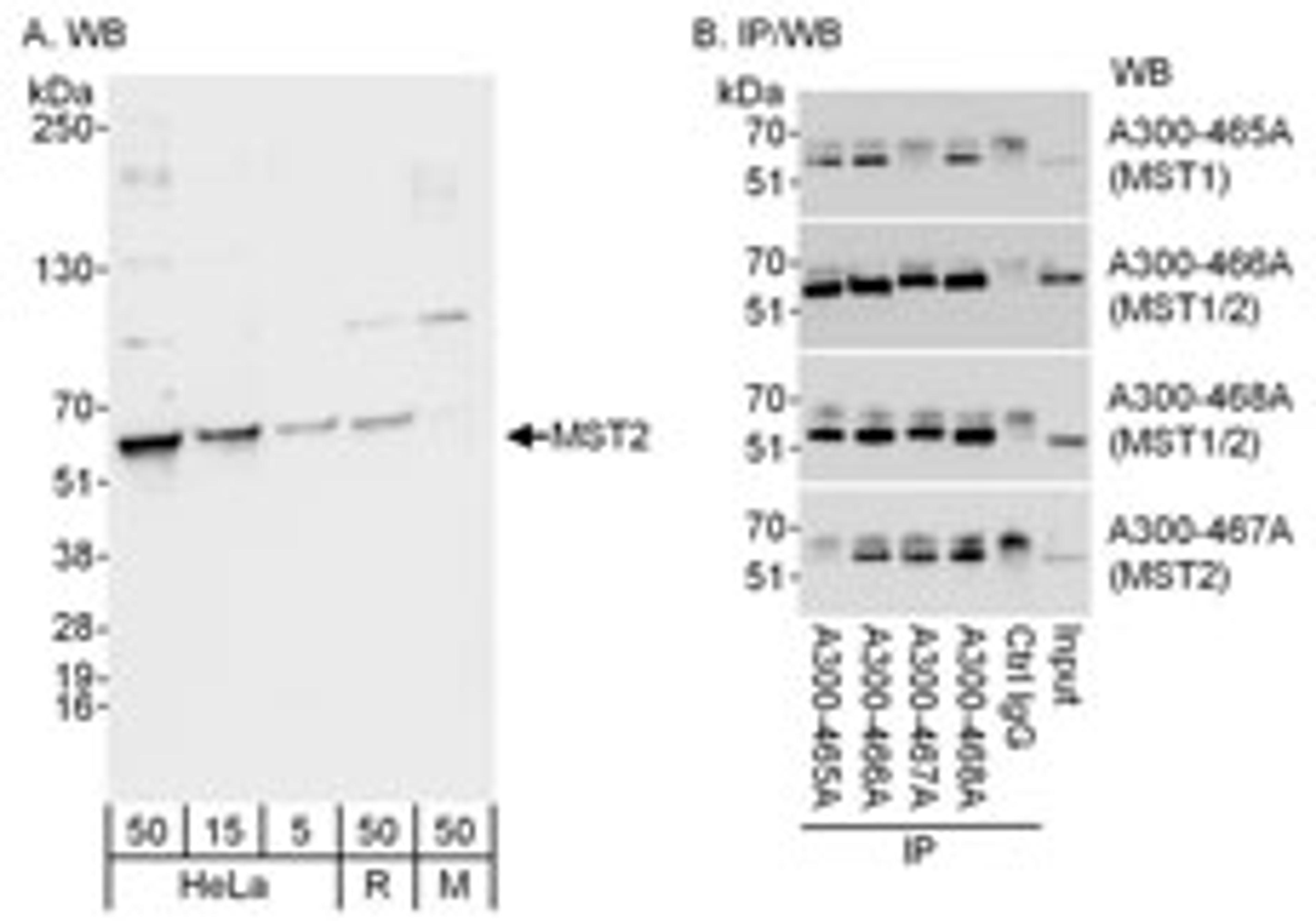 Detection of MST1 and MST2 by western blot and immunoprecipitation.