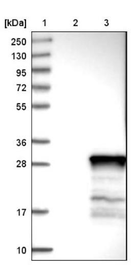 Western Blot: C22orf33 Antibody [NBP1-81096] - Lane 1: Marker [kDa] 250, 130, 95, 72, 55, 36, 28, 17, 10<br/>Lane 2: Negative control (vector only transfected HEK293T lysate)<br/>Lane 3: Over-expression lysate (Co-expressed with a C-terminal myc-DDK tag (~3.1 kDa) in mammalian HEK293T cells, LY405921)