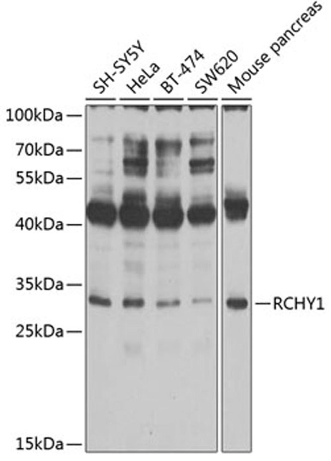 Western blot - RCHY1 antibody (A2789)