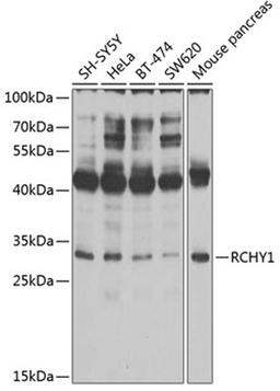 Western blot - RCHY1 antibody (A2789)