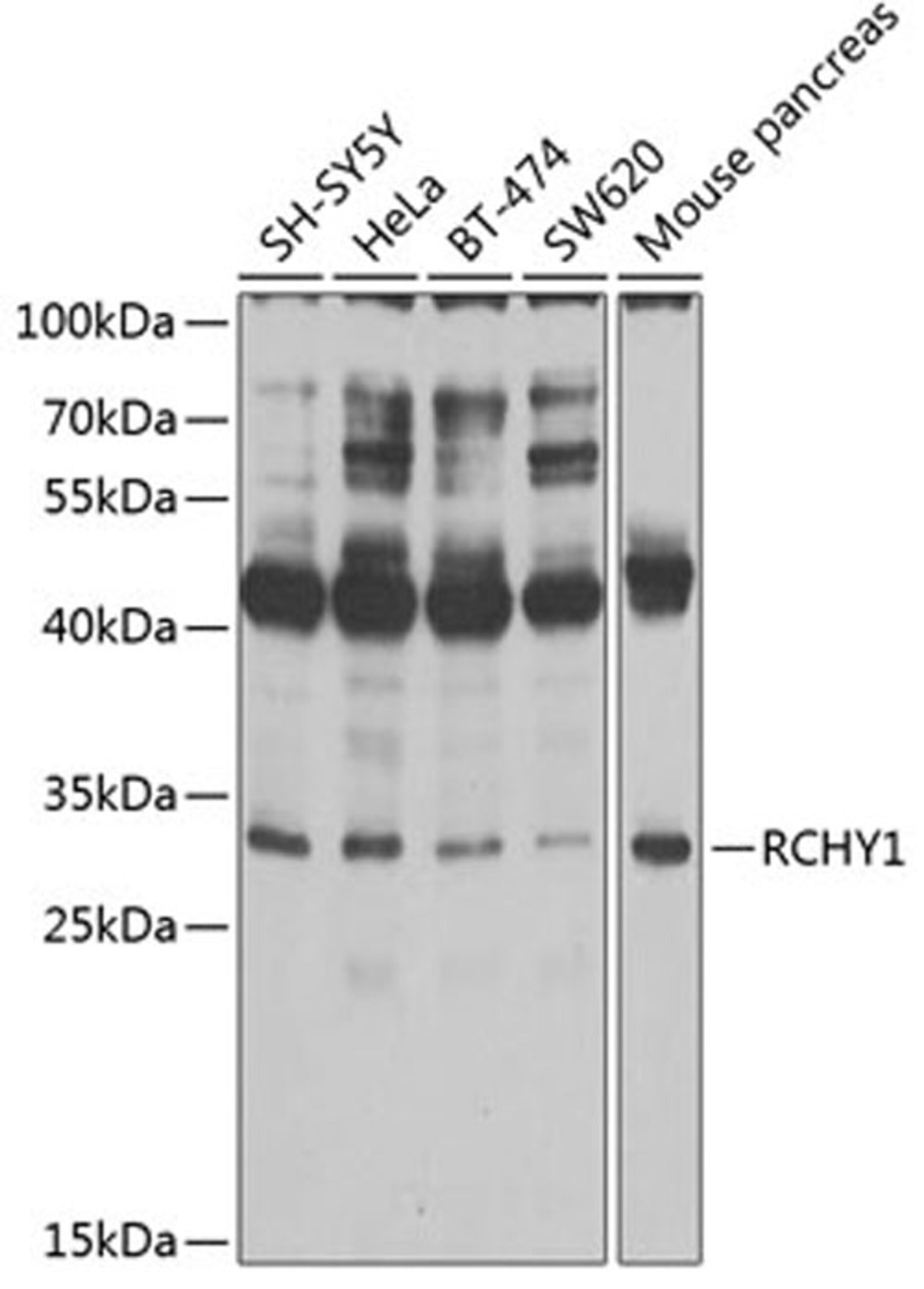 Western blot - RCHY1 antibody (A2789)