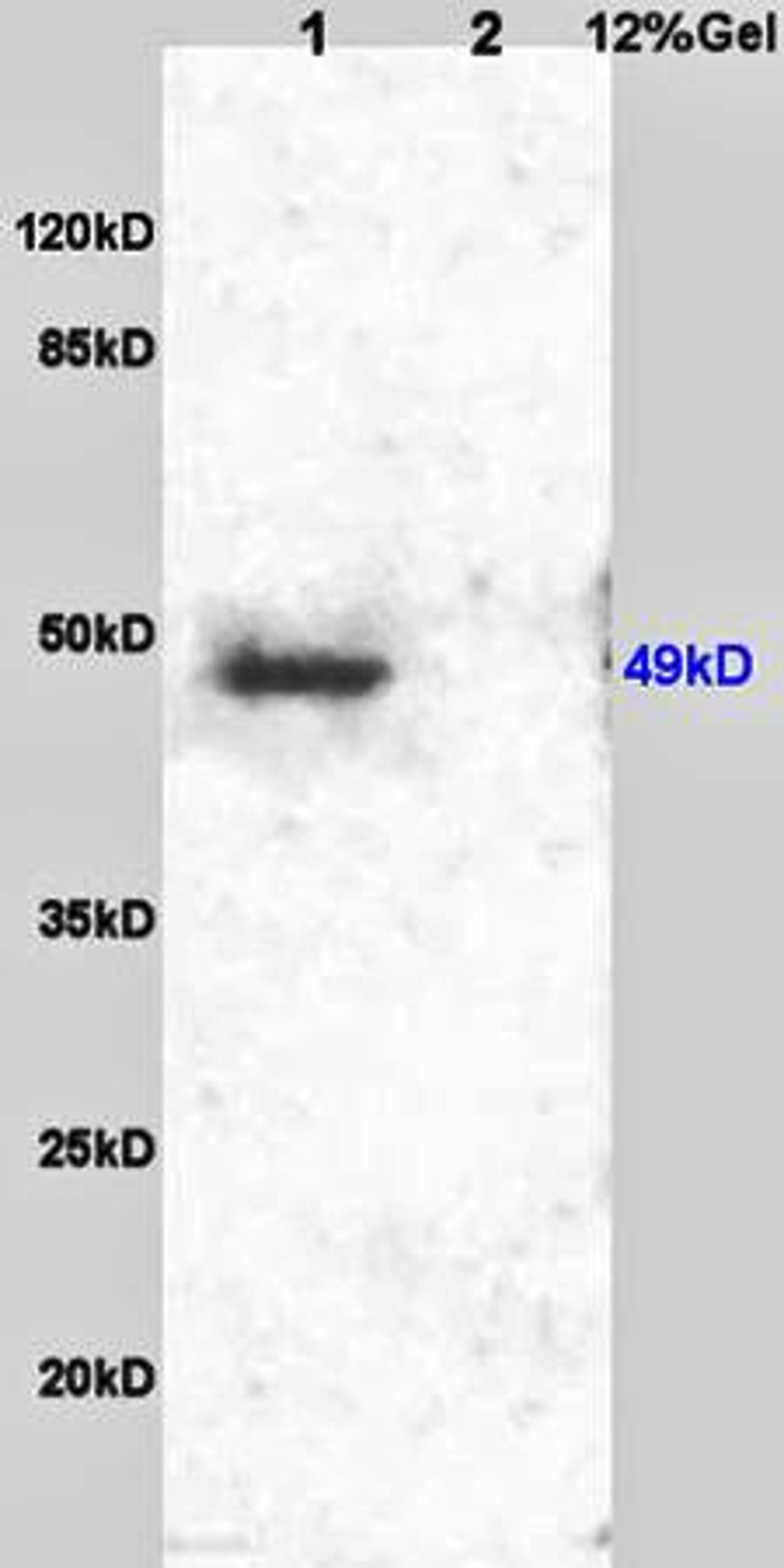 Western blot analysis of mouse embryos lysates(Lane1),human colon carcinoma lysates(Lane2) using GDF9 antibody