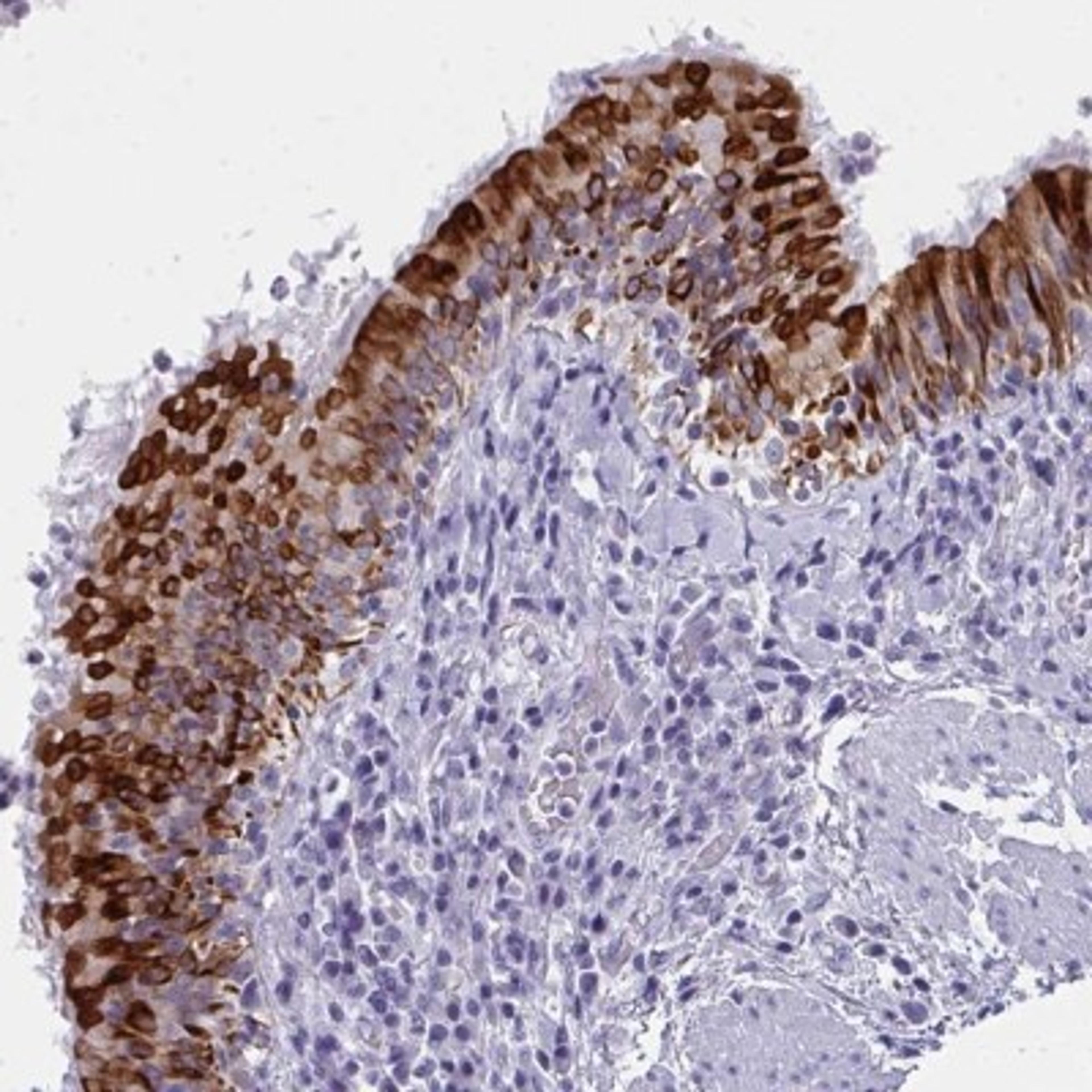 Immunohistochemistry: RIMKB Antibody [NBP2-31778] - Staining of human bronchus shows strong cytoplasmic positivity in respiratory epithelial cells.