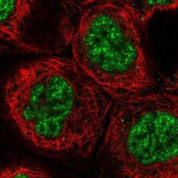 Immunocytochemistry/Immunofluorescence: UBE3B Antibody [NBP1-92559] - Staining of human cell line A-431 shows positivity in nucleus but not nucleoli.