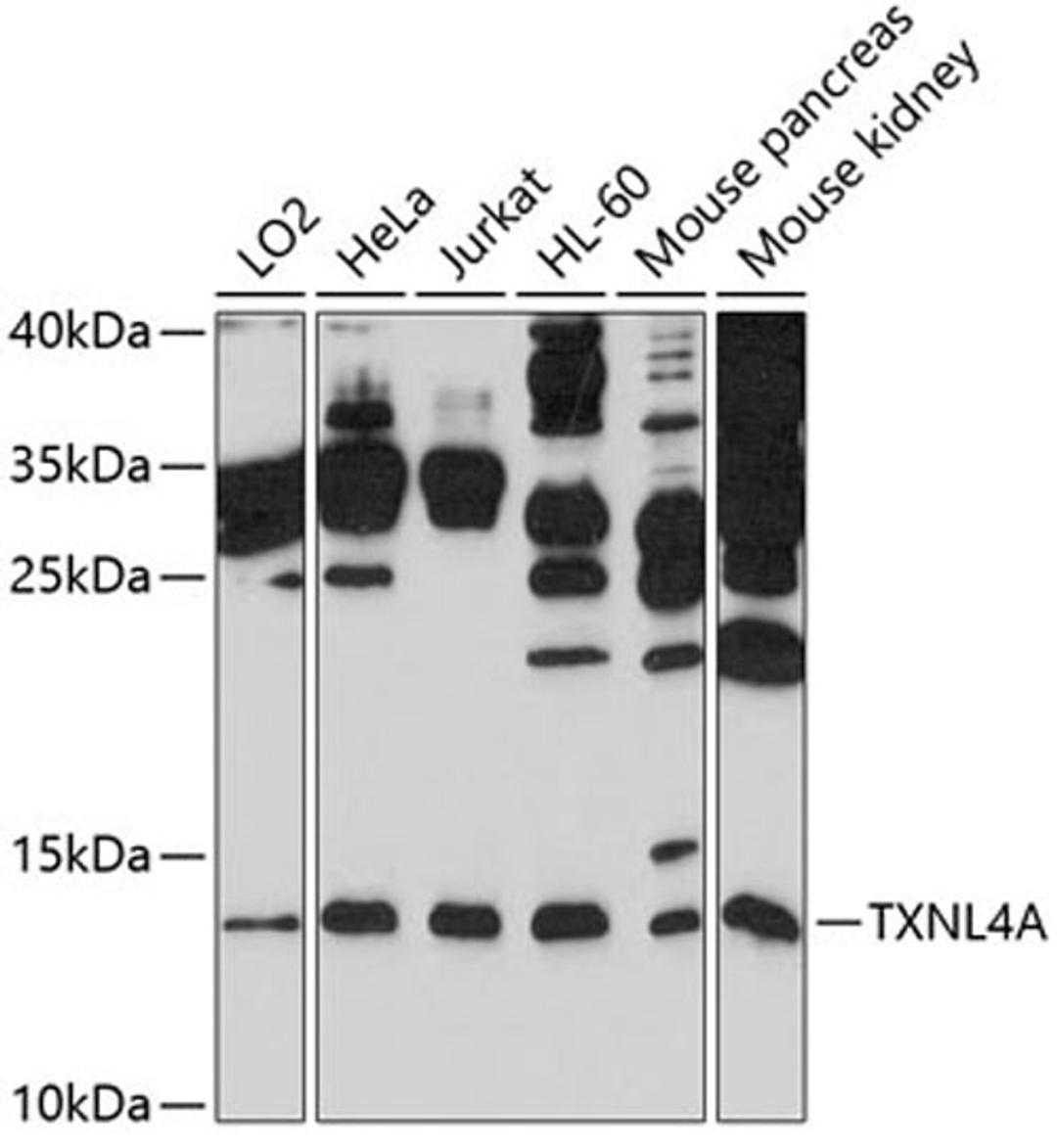 Western blot - TXNL4A antibody (A10138)