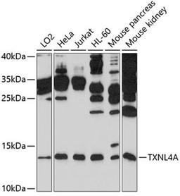 Western blot - TXNL4A antibody (A10138)