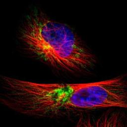 Immunocytochemistry/Immunofluorescence: TIMM9 Antibody [NBP1-80679] - Staining of human cell line U-251MG shows positivity in mitochondria.