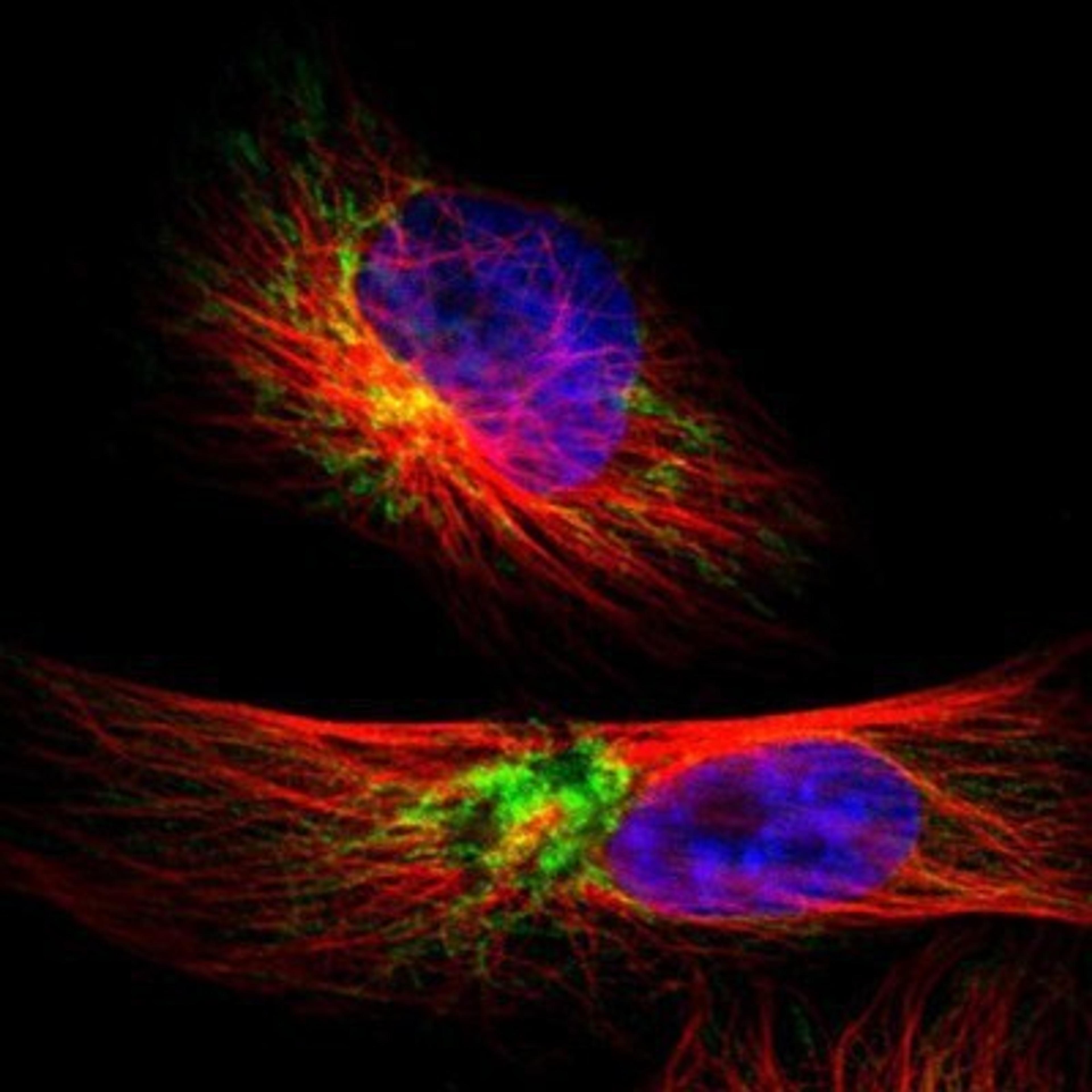 Immunocytochemistry/Immunofluorescence: TIMM9 Antibody [NBP1-80679] - Staining of human cell line U-251MG shows positivity in mitochondria.