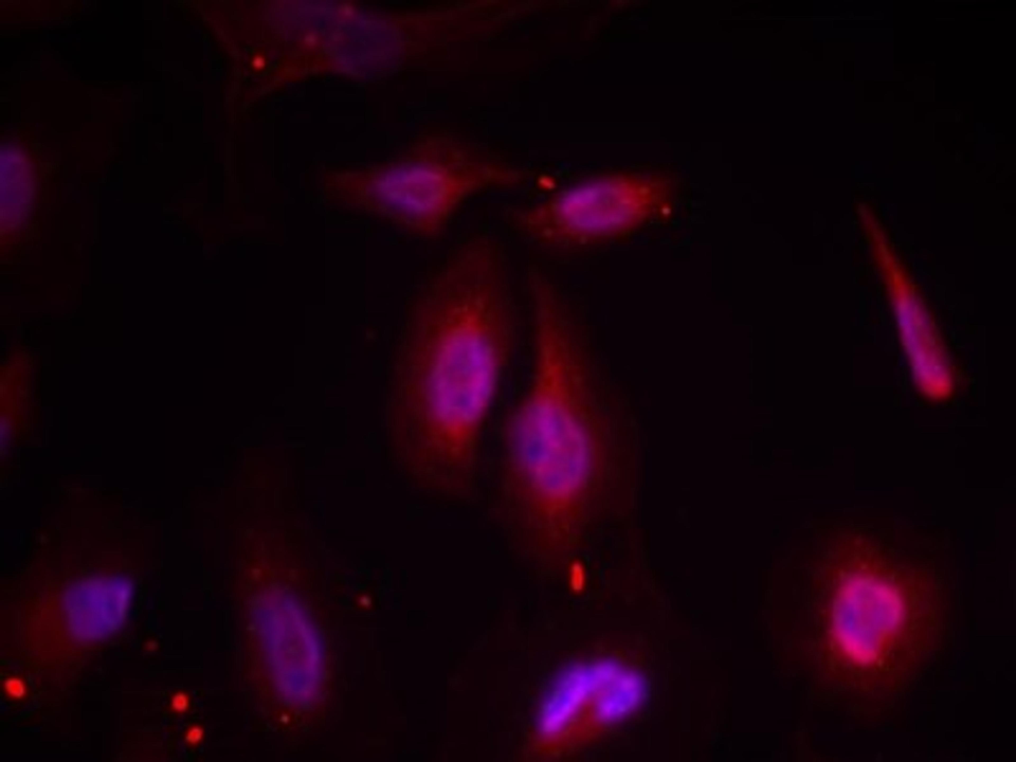 Immunocytochemistry/Immunofluorescence: ATF2 [p Thr69] Antibody [NB100-81798] - Staining of methanol-fixed Hela cells using ATF2 (Phospho-Thr69 or 51) antibody