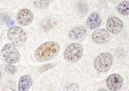 Detection of human p66beta/GATAD2B by immunohistochemistry.