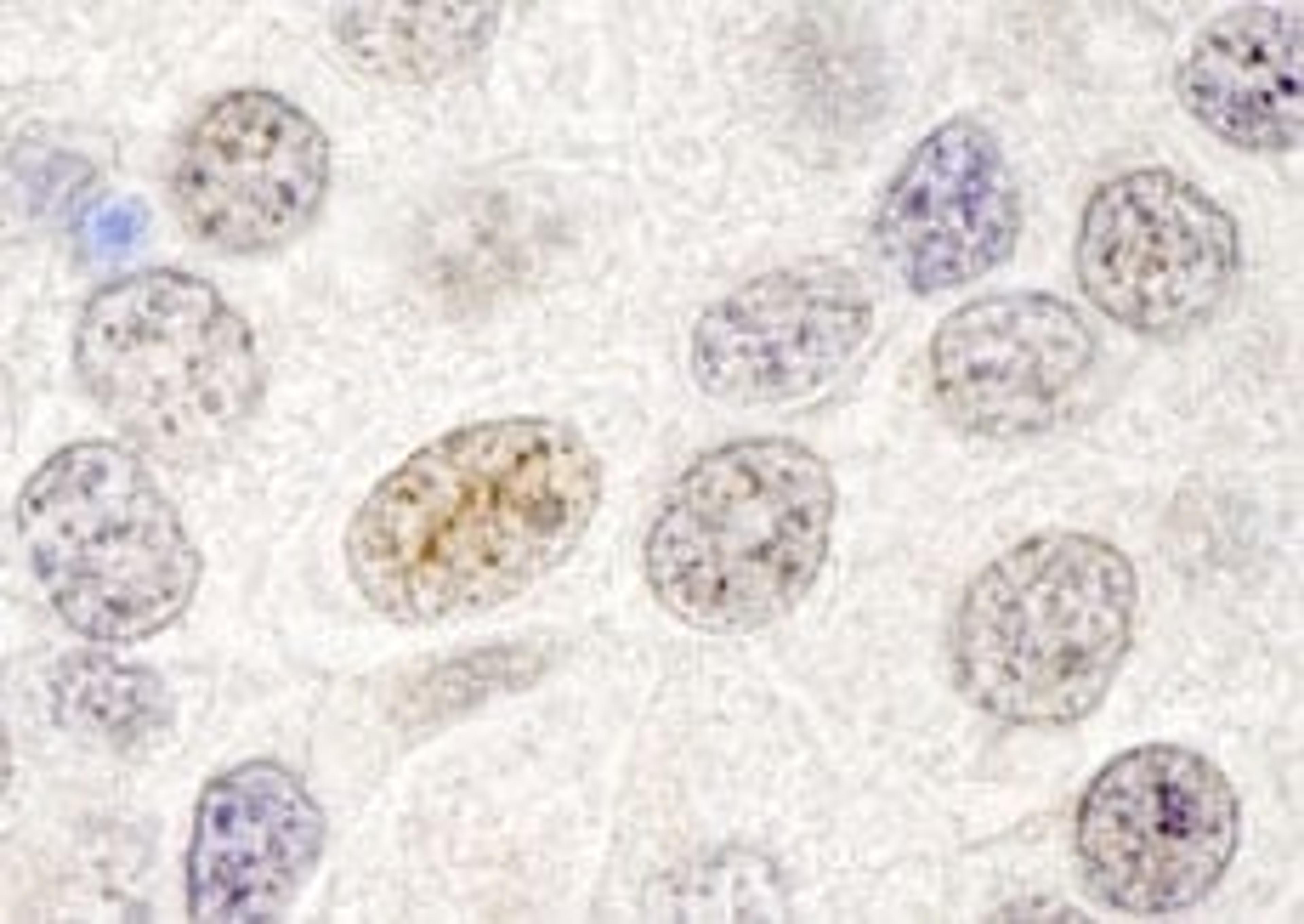 Detection of human p66beta/GATAD2B by immunohistochemistry.