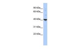 Antibody used in WB on Human HepG2 at 0.2-1 ug/ml.