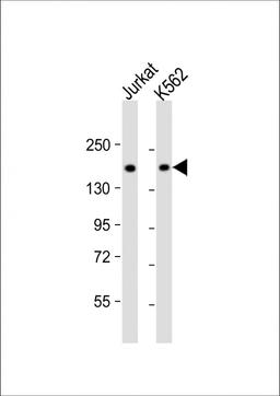 Western Blot at 1:1000 dilution Lane 1: Jurkat whole cell lysate Lane 2: K562 whole cell lysate Lysates/proteins at 20 ug per lane.