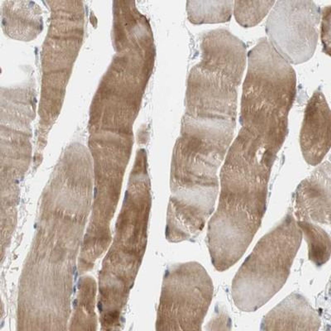 Immunohistochemistry: Collagen XII alpha1 Antibody [NBP1-88062] - Immunohistochemical staining of human skeletal muscle shows moderate cytoplasmic positivity in myocytes.