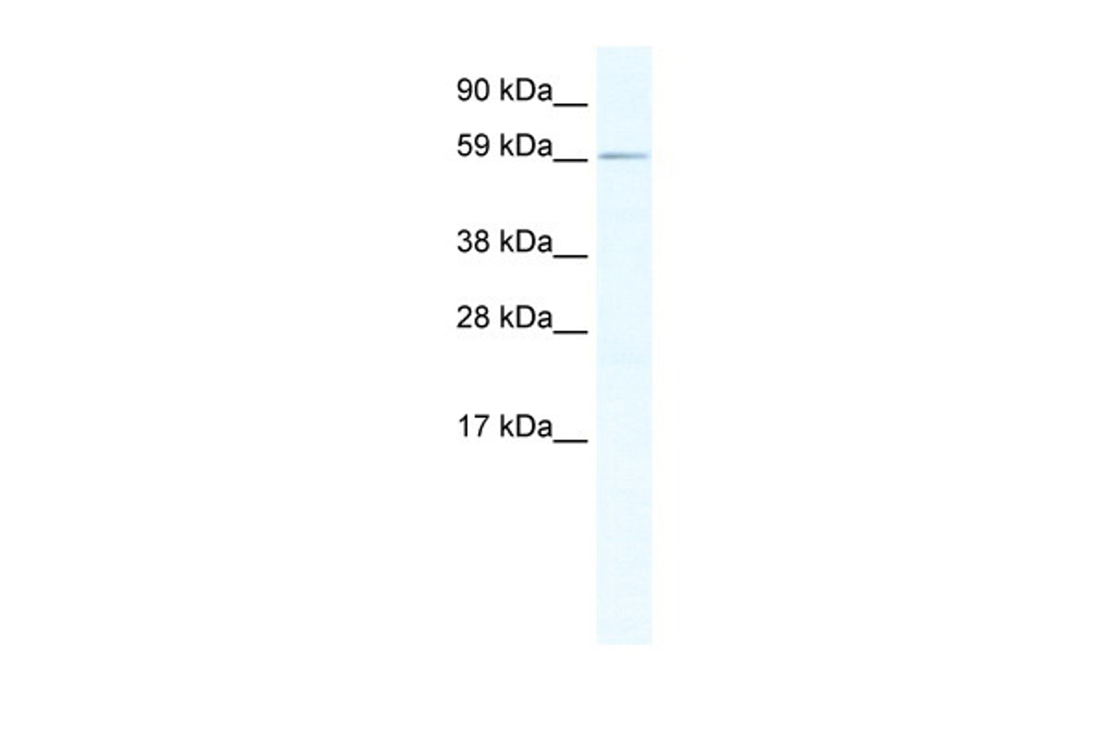 Antibody used in WB on Mouse SP2/0 at 1.25 ug/ml.