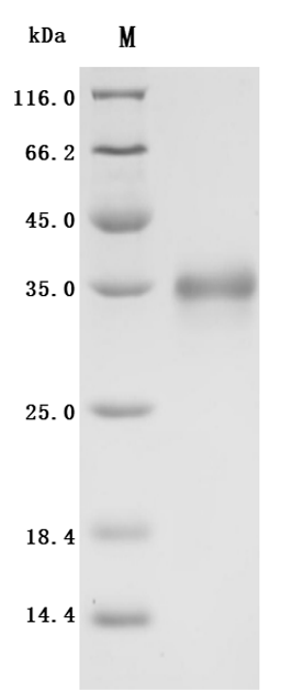 (Tris-Glycine gel) Discontinuous SDS-PAGE (reduced) with 5% enrichment gel and 15% separation gel.