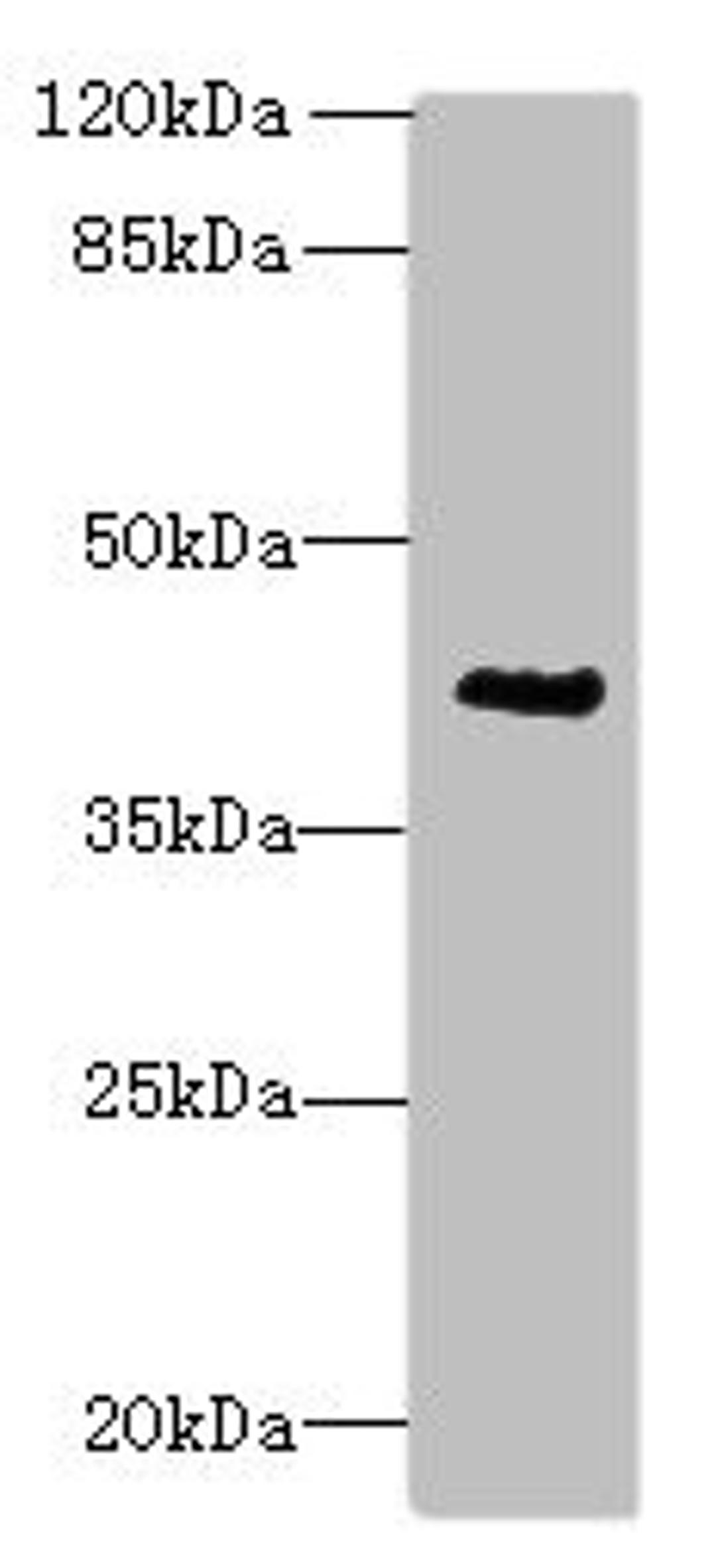 Western blot. All lanes: ACTG2 antibody at 3µg/ml + CEM whole cell lysate. Secondary. Goat polyclonal to rabbit IgG at 1/10000 dilution. Predicted band size: 42, 38 kDa. Observed band size: 42 kDa