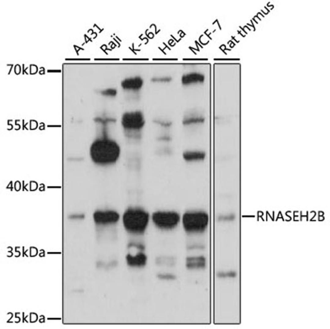 Western blot - RNASEH2B antibody (A4972)