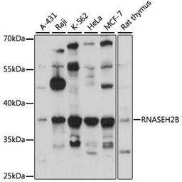 Western blot - RNASEH2B antibody (A4972)